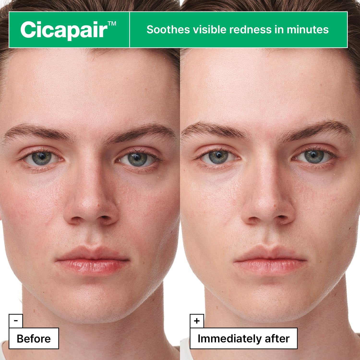 Centella Cica Soothing Sheet Mask